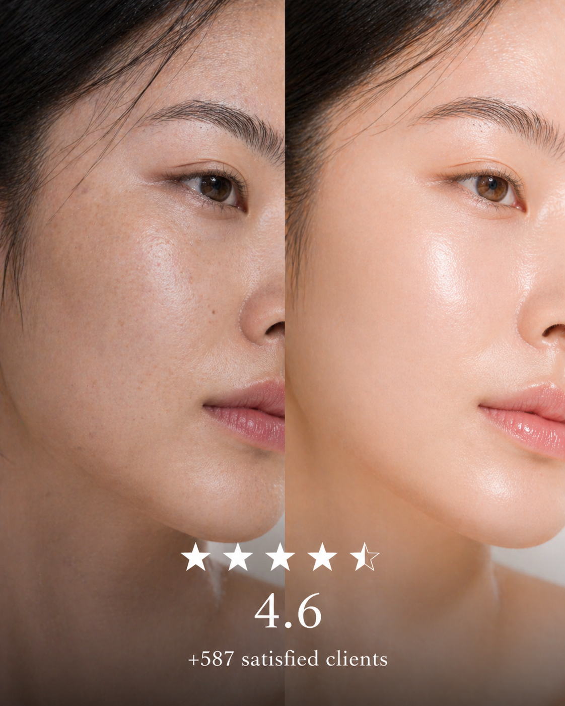 Crème Subin